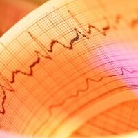 heart failure (HF) congestive heart failure (HF)